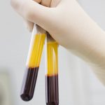 Blood tubes in two layers divided by centrifuge after